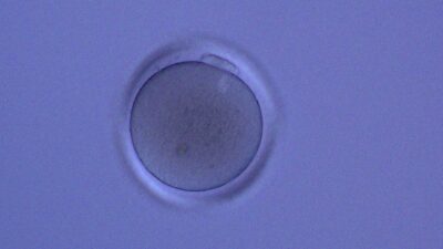 卵子ってどれくらい小さい?|培養士が教える「卵子の大きさ」のアイキャッチ画像