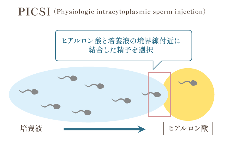 PICSI（ヒアルロン酸を用いた生理学的精子選択術）