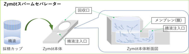 Zymōt（膜構造を用いた生理学的精子選択術）