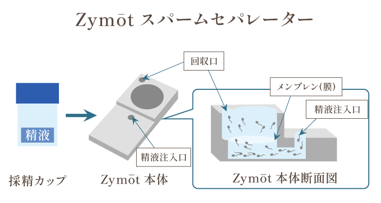 Zymōt（膜構造を用いた生理学的精子選択術）